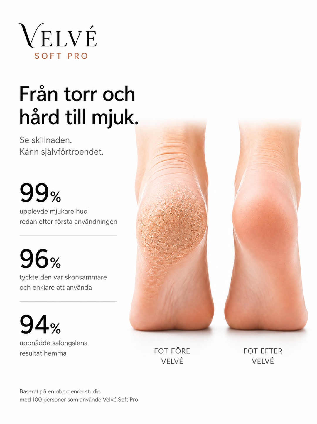 Velvé Soft Pro X